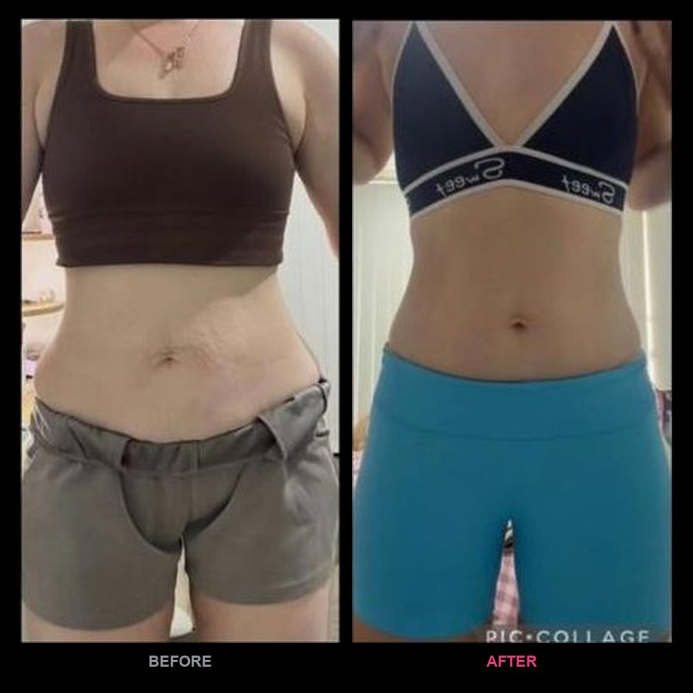 Skye's before and after transformation with Top Tier Physique